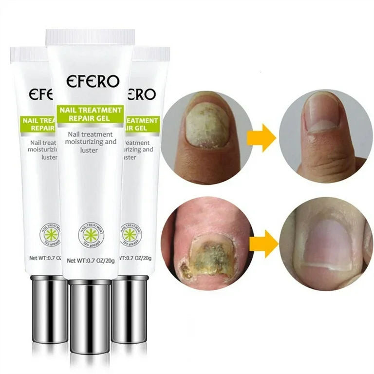 Efero Nails Treatment Gel – Traitement Antifongique Réparateur